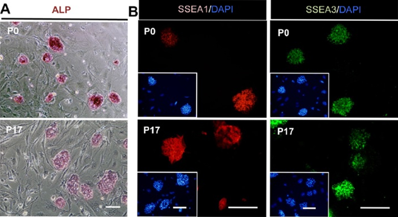 iPS cells