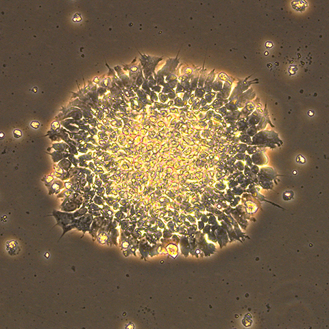 Human iPS cells cultured in our laboratory at Koyasu office/research park.